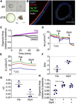 Anion Transport Across Human Gallbladder Organoids and Monolayers